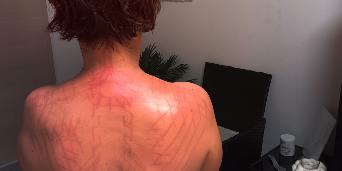 Anti-Cellulite-Massage
